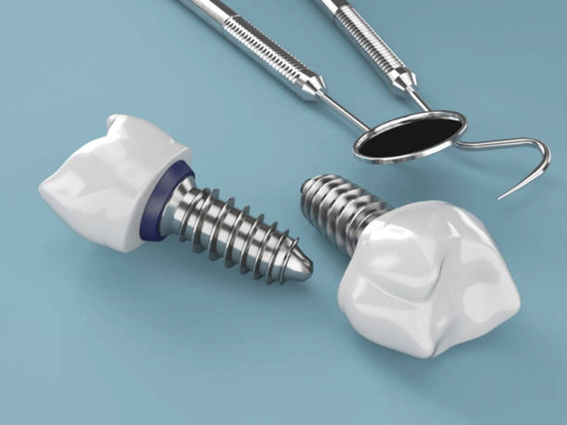 Titanium fasteners Titanium fasteners