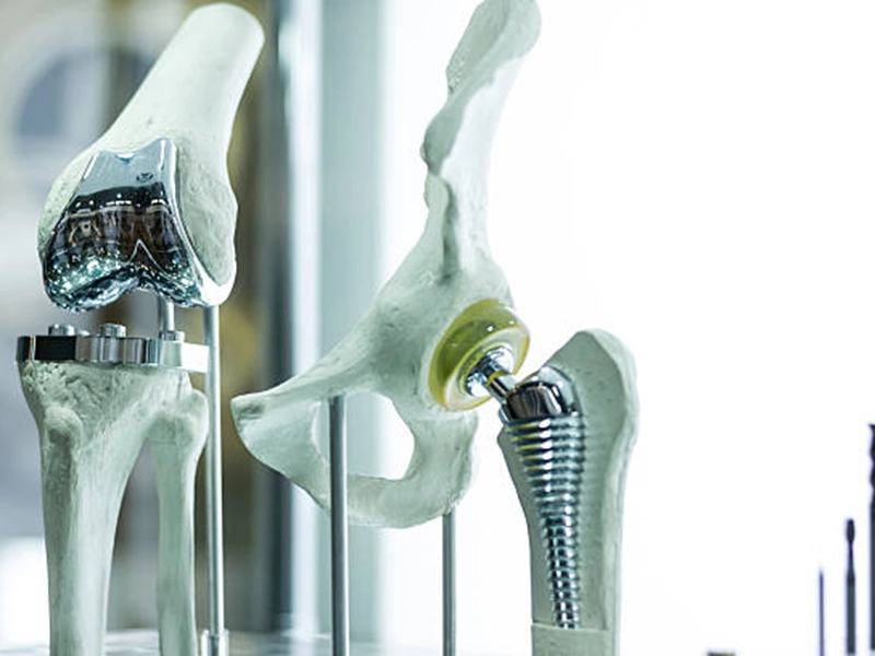 Titanium fasteners Titanium fasteners